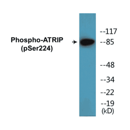 Western Blot - ATRIP (phospho Ser224) Cell Based ELISA Kit (CBP1807) - Antibodies.com