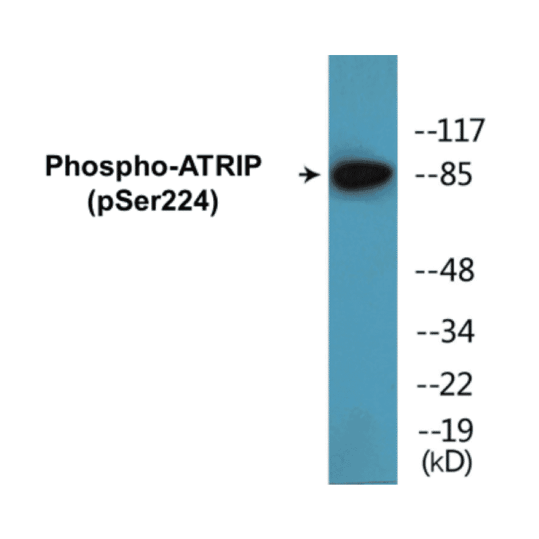 Western Blot - ATRIP (phospho Ser224) Cell Based ELISA Kit (CBP1807) - Antibodies.com