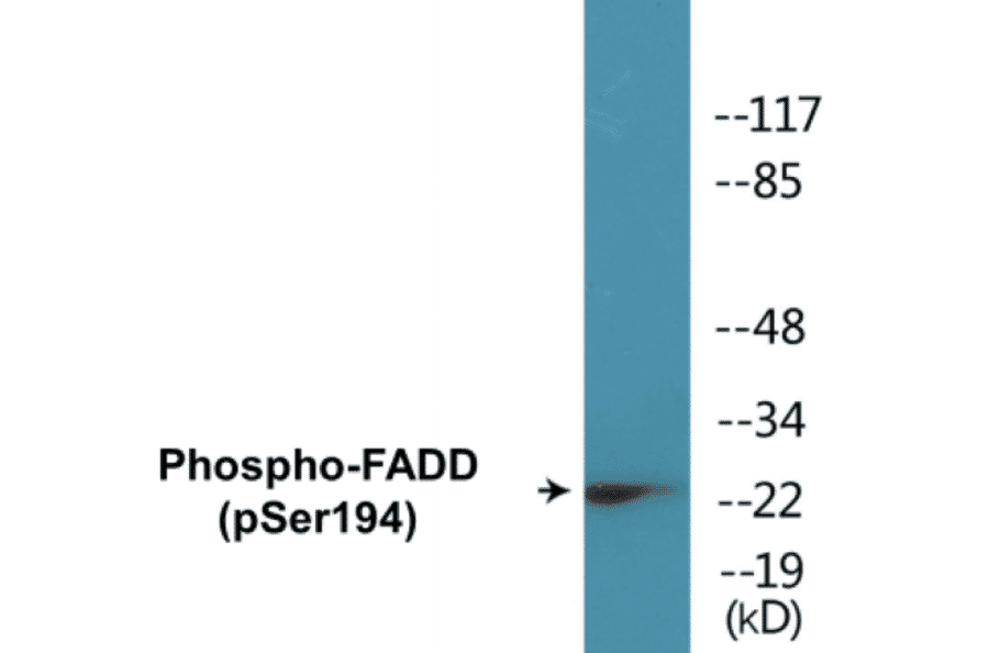 Western Blot - FADD (phospho Ser194) Cell Based ELISA Kit (CBP1114) - Antibodies.com