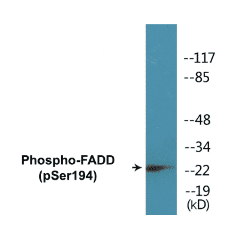 Western Blot - FADD (phospho Ser194) Cell Based ELISA Kit (CBP1114) - Antibodies.com