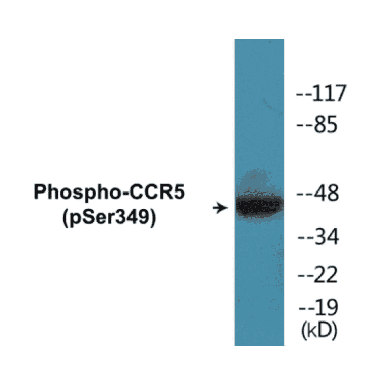 Western Blot - CCR5 (phospho Ser349) Cell Based ELISA Kit (CBP1055) - Antibodies.com