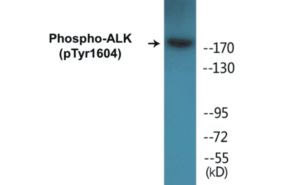 Western Blot - ALK (phospho Tyr1604) Cell Based ELISA Kit (CBP1242) - Antibodies.com