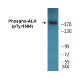 Western Blot - ALK (phospho Tyr1604) Cell Based ELISA Kit (CBP1242) - Antibodies.com