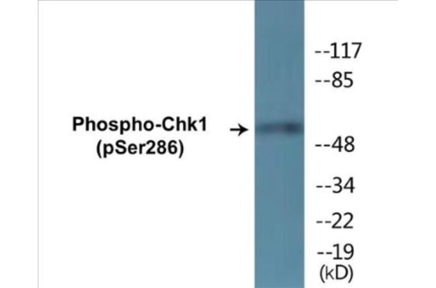 Western Blot - Chk1 (phospho Ser286) Cell Based ELISA Kit (CBP1345) - Antibodies.com