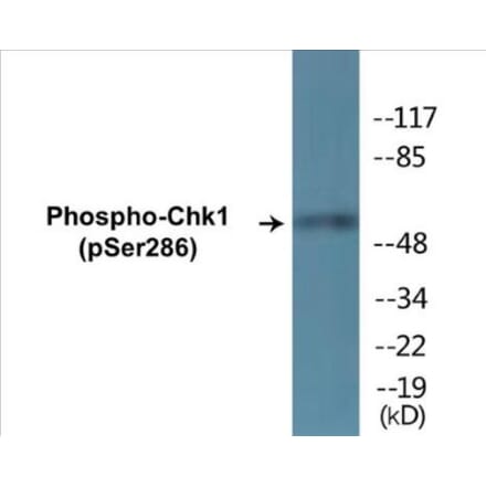 Western Blot - Chk1 (phospho Ser286) Cell Based ELISA Kit (CBP1345) - Antibodies.com