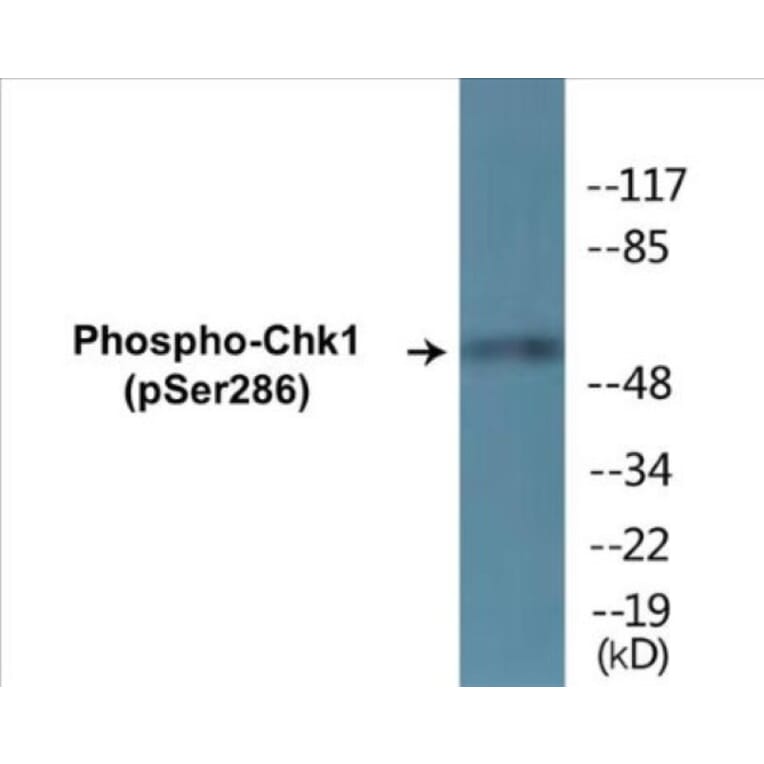 Western Blot - Chk1 (phospho Ser286) Cell Based ELISA Kit (CBP1345) - Antibodies.com