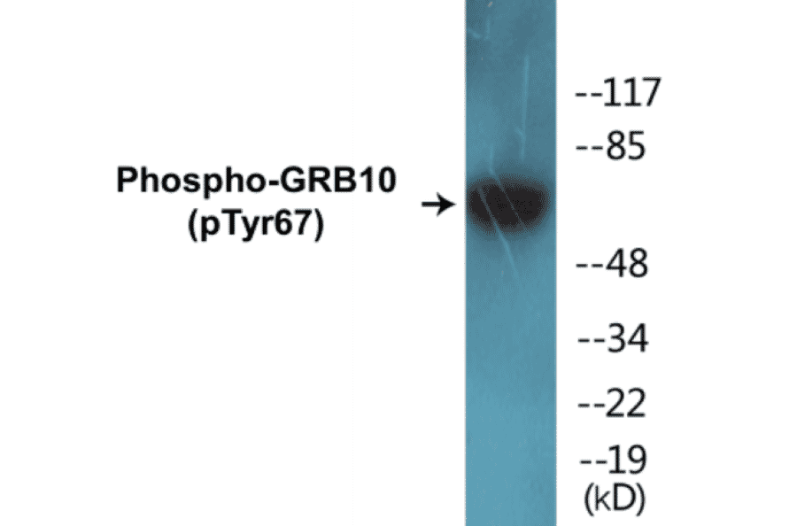 Western Blot - GRB10 (phospho Tyr67) Cell Based ELISA Kit (CBP1406) - Antibodies.com
