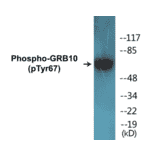 Western Blot - GRB10 (phospho Tyr67) Cell Based ELISA Kit (CBP1406) - Antibodies.com
