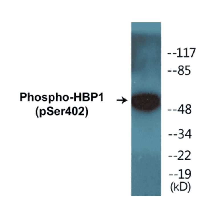 Western Blot - HBP1 (phospho Ser402) Cell Based ELISA Kit (CBP1408) - Antibodies.com