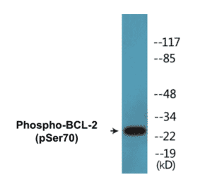 Western Blot - BCL-2 (phospho Ser70) Cell Based ELISA Kit (CBP1505) - Antibodies.com