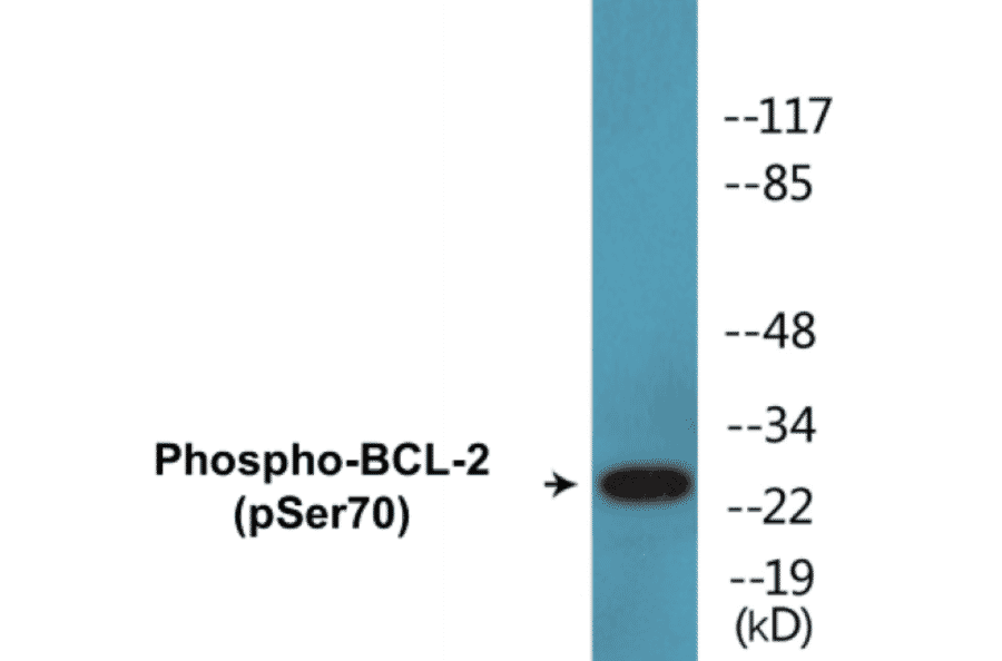Western Blot - BCL-2 (phospho Ser70) Cell Based ELISA Kit (CBP1505) - Antibodies.com