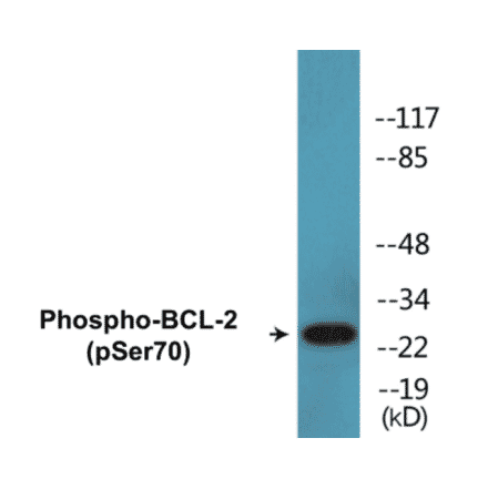 Western Blot - BCL-2 (phospho Ser70) Cell Based ELISA Kit (CBP1505) - Antibodies.com