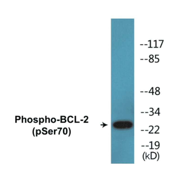 Western Blot - BCL-2 (phospho Ser70) Cell Based ELISA Kit (CBP1505) - Antibodies.com