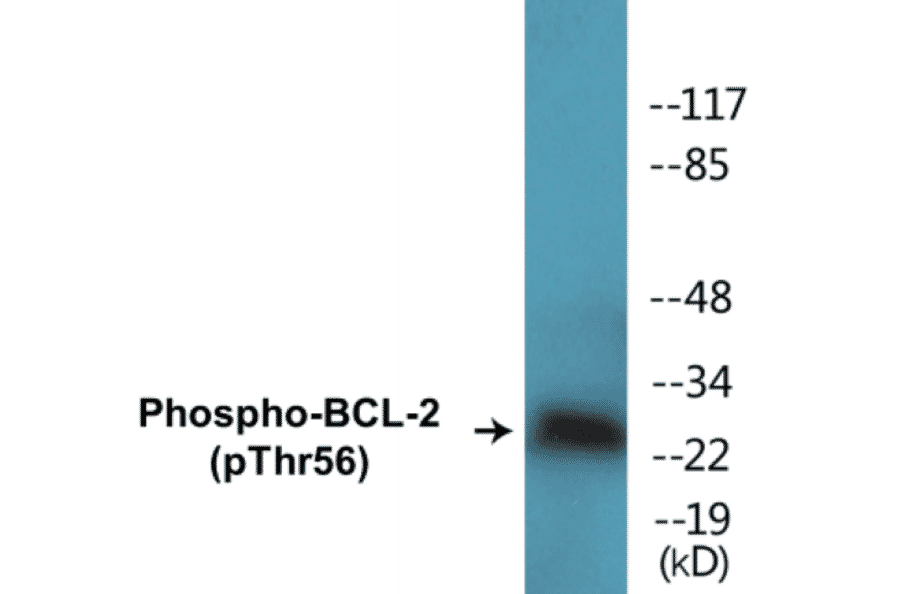 Western Blot - BCL-2 (phospho Thr56) Cell Based ELISA Kit (CBP1506) - Antibodies.com