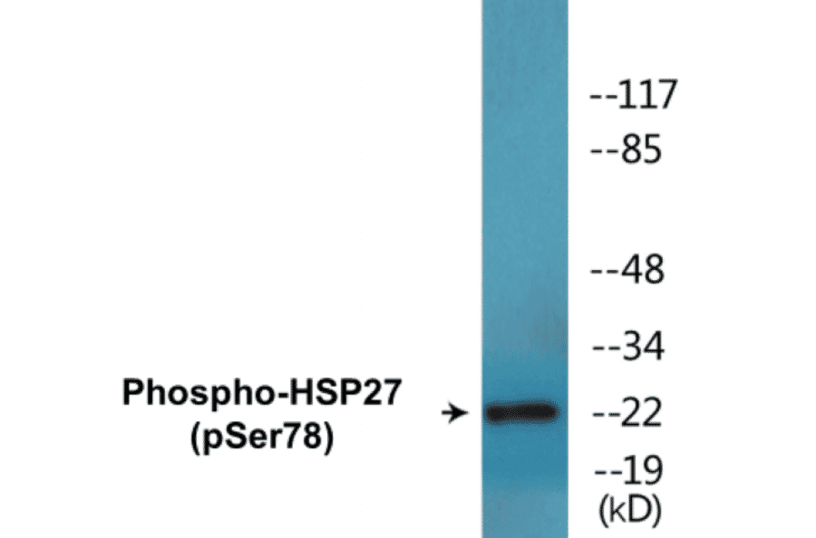 Western Blot - HSP27 (phospho Ser78) Cell Based ELISA Kit (CBP1580) - Antibodies.com