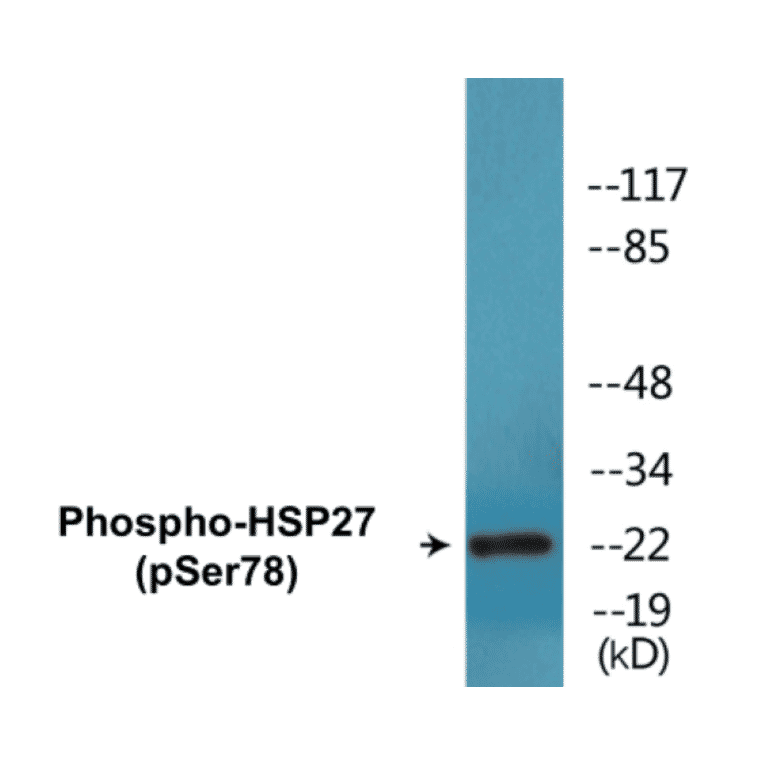 Western Blot - HSP27 (phospho Ser78) Cell Based ELISA Kit (CBP1580) - Antibodies.com