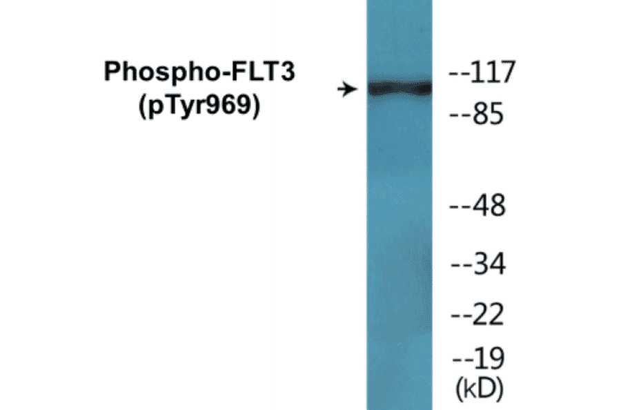 Western Blot - FLT3 (phospho Tyr969) Cell Based ELISA Kit (CBP1744) - Antibodies.com