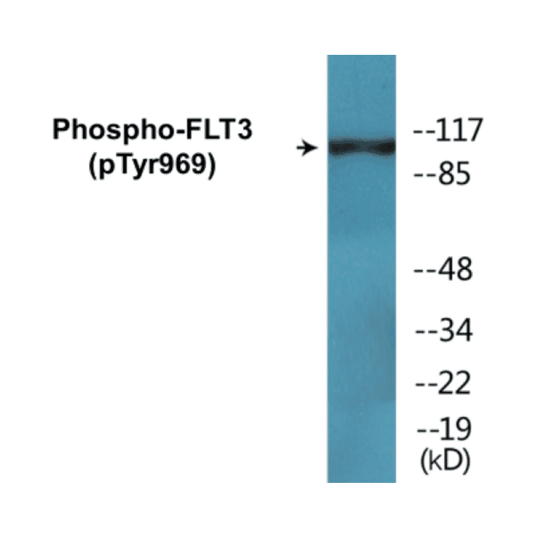 Western Blot - FLT3 (phospho Tyr969) Cell Based ELISA Kit (CBP1744) - Antibodies.com