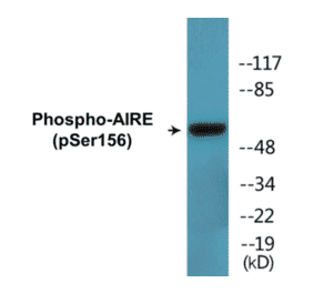 Western Blot - AIRE (phospho Ser156) Cell Based ELISA Kit (CBP1805) - Antibodies.com