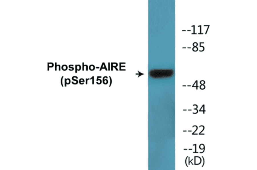 Western Blot - AIRE (phospho Ser156) Cell Based ELISA Kit (CBP1805) - Antibodies.com
