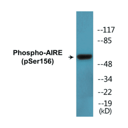 Western Blot - AIRE (phospho Ser156) Cell Based ELISA Kit (CBP1805) - Antibodies.com