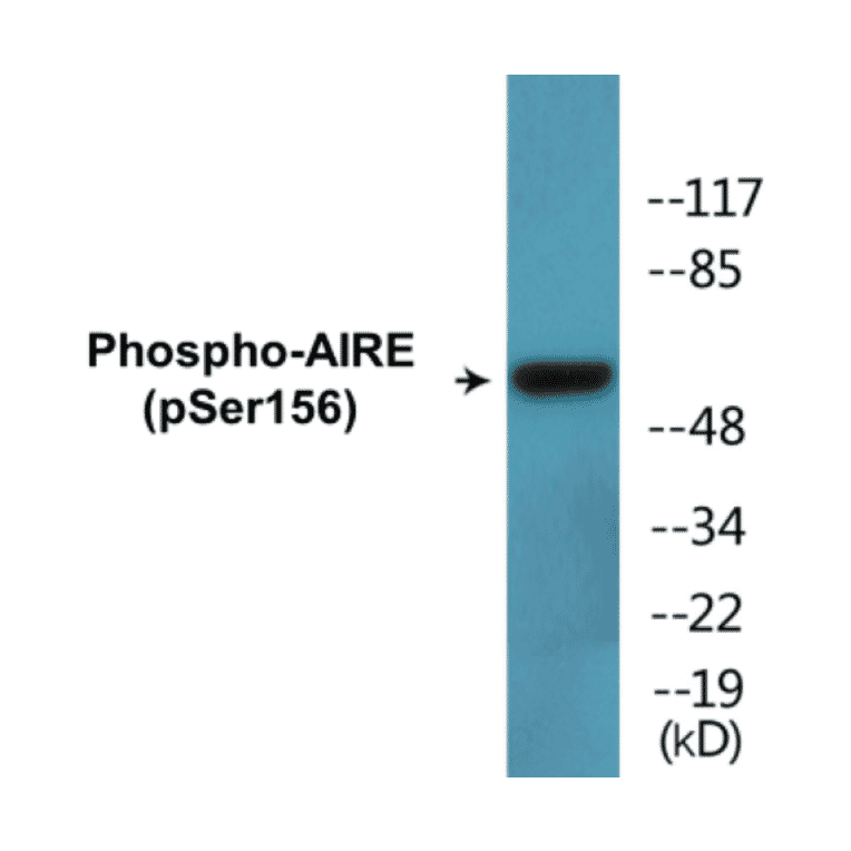 Western Blot - AIRE (phospho Ser156) Cell Based ELISA Kit (CBP1805) - Antibodies.com