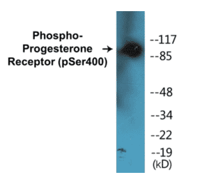 Western Blot - Progesterone Receptor (phospho Ser400) Cell Based ELISA Kit (CBP1208) - Antibodies.com