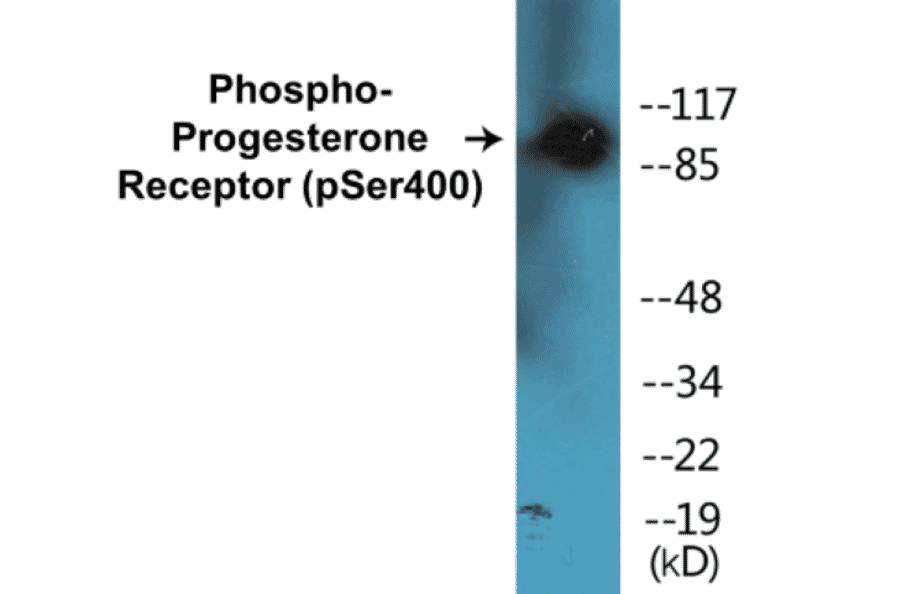 Western Blot - Progesterone Receptor (phospho Ser400) Cell Based ELISA Kit (CBP1208) - Antibodies.com