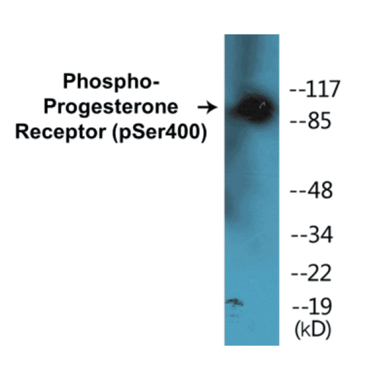 Western Blot - Progesterone Receptor (phospho Ser400) Cell Based ELISA Kit (CBP1208) - Antibodies.com