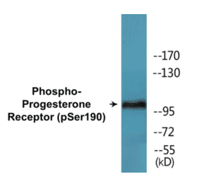 Western Blot - Progesterone Receptor (phospho Ser190) Cell Based ELISA Kit (CBP1660) - Antibodies.com