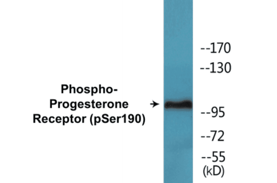 Western Blot - Progesterone Receptor (phospho Ser190) Cell Based ELISA Kit (CBP1660) - Antibodies.com