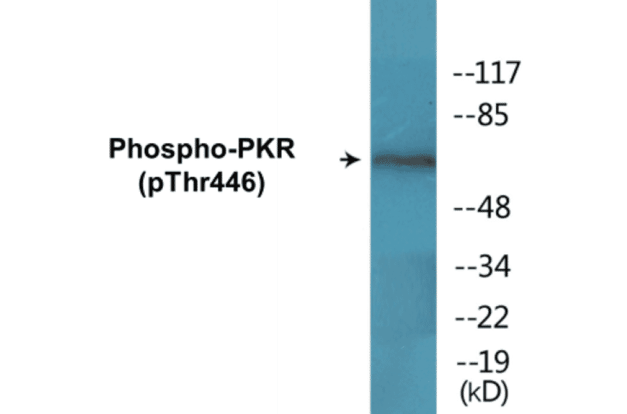 Western Blot - PKR (phospho Thr446) Cell Based ELISA Kit (CBP1659) - Antibodies.com