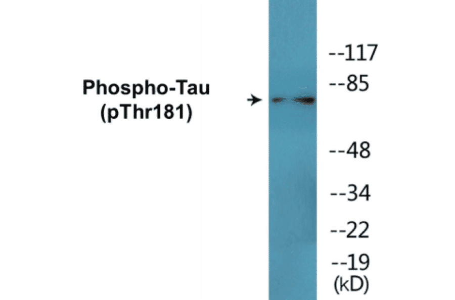 Western Blot - Tau (phospho Thr181) Cell Based ELISA Kit (CBP1700) - Antibodies.com