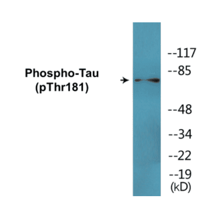 Western Blot - Tau (phospho Thr181) Cell Based ELISA Kit (CBP1700) - Antibodies.com