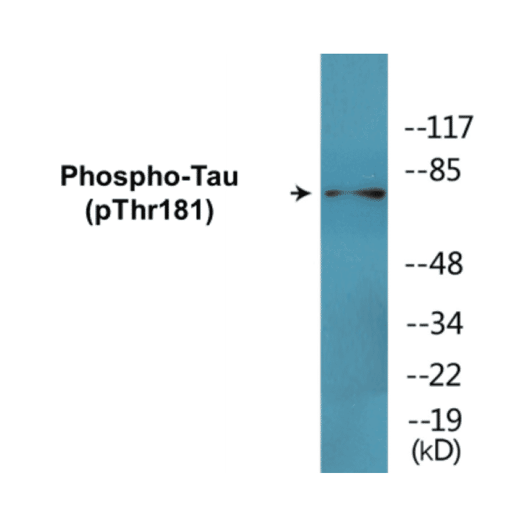 Western Blot - Tau (phospho Thr181) Cell Based ELISA Kit (CBP1700) - Antibodies.com