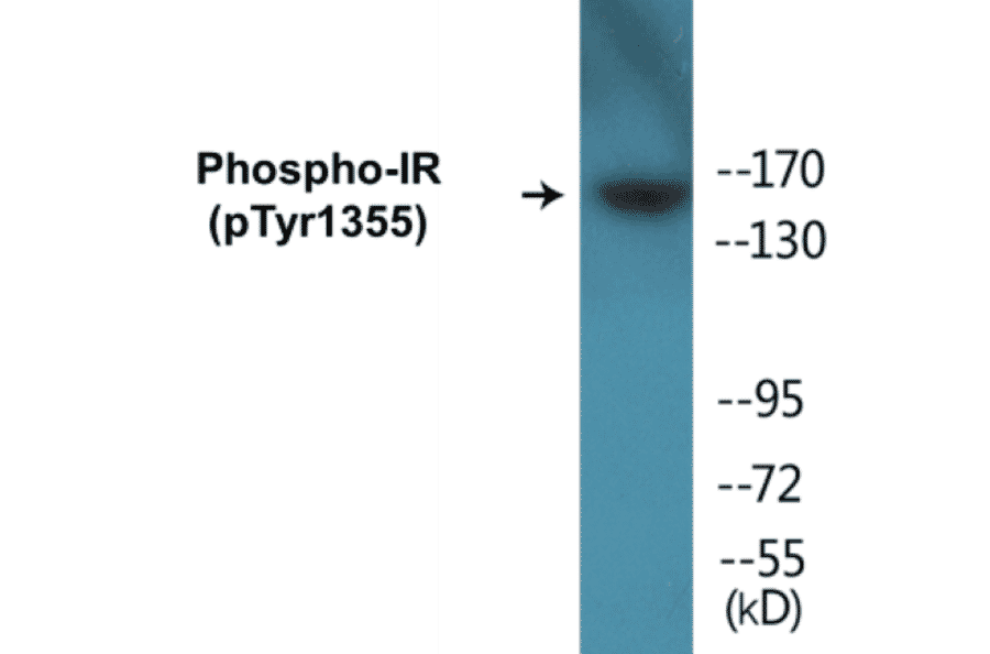 Western Blot - IR (phospho Tyr1355) Cell Based ELISA Kit (CBP1164) - Antibodies.com