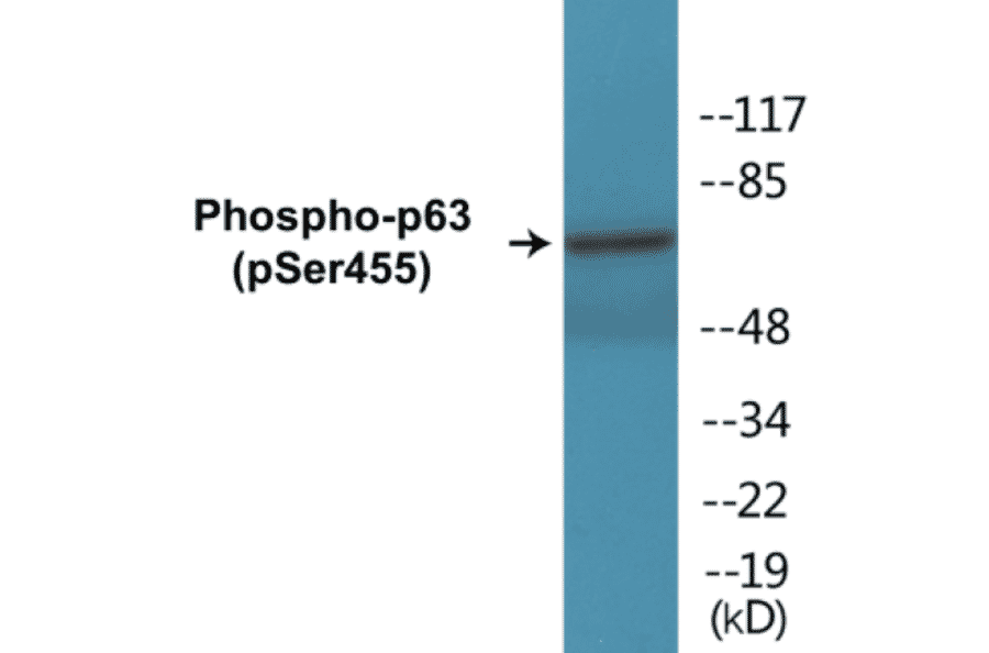Western Blot - p63 (phospho Ser455) Cell Based ELISA Kit (CBP1268) - Antibodies.com