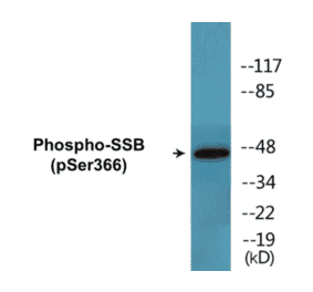Western Blot - SSB (phospho Ser366) Cell Based ELISA Kit (CBP1459) - Antibodies.com