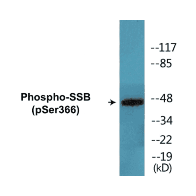 Western Blot - SSB (phospho Ser366) Cell Based ELISA Kit (CBP1459) - Antibodies.com