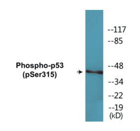 Western Blot - p53 (phospho Ser315) Cell Based ELISA Kit (CBP1643) - Antibodies.com