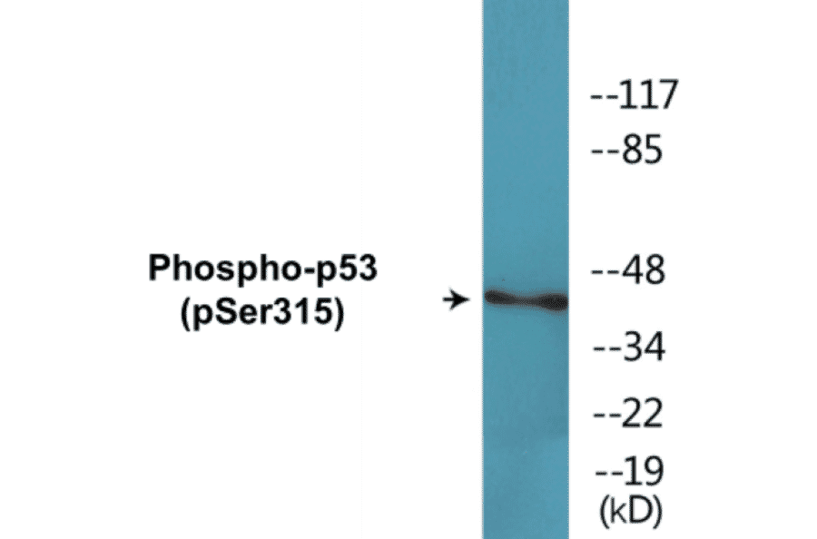 Western Blot - p53 (phospho Ser315) Cell Based ELISA Kit (CBP1643) - Antibodies.com
