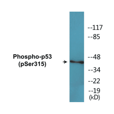 Western Blot - p53 (phospho Ser315) Cell Based ELISA Kit (CBP1643) - Antibodies.com