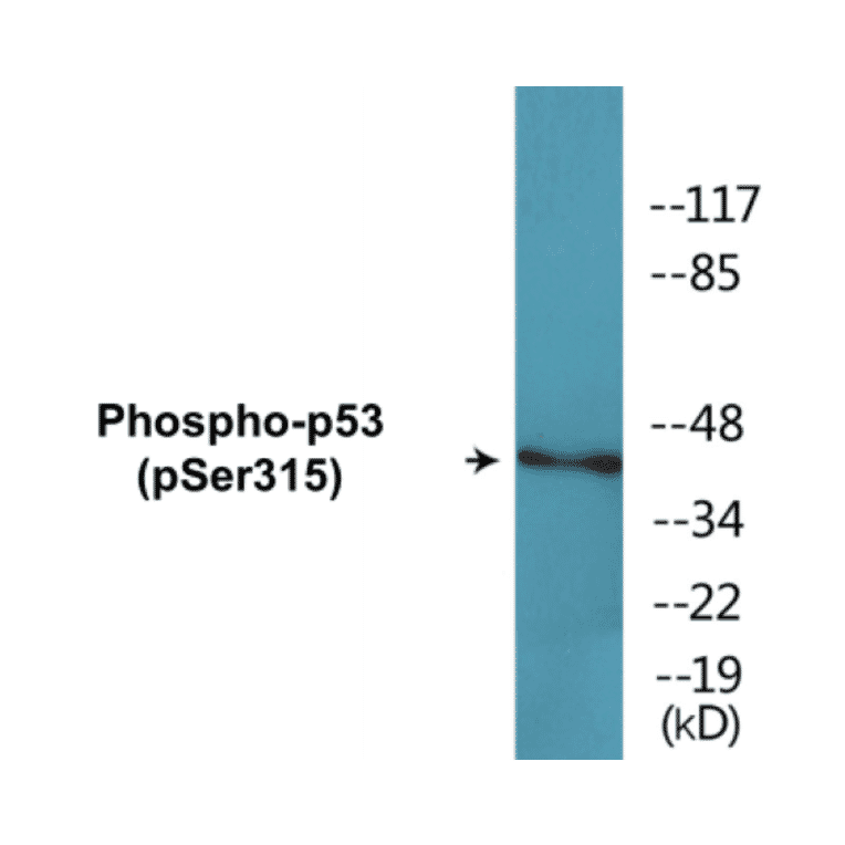 Western Blot - p53 (phospho Ser315) Cell Based ELISA Kit (CBP1643) - Antibodies.com