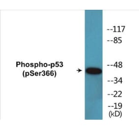 Western Blot - p53 (phospho Ser366) Cell Based ELISA Kit (CBP1727) - Antibodies.com