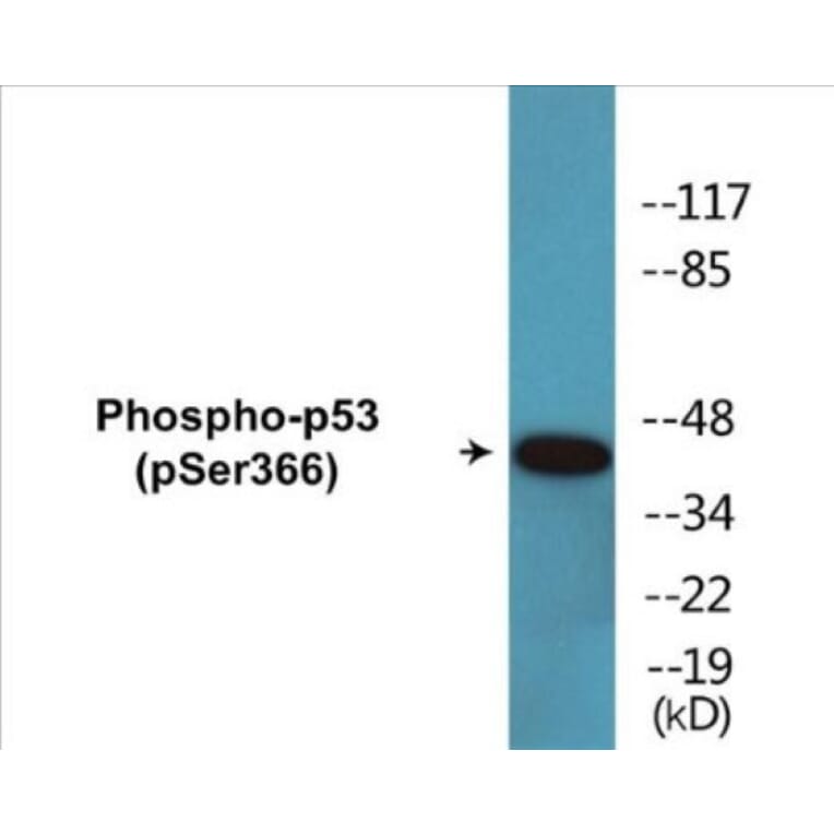 Western Blot - p53 (phospho Ser366) Cell Based ELISA Kit (CBP1727) - Antibodies.com