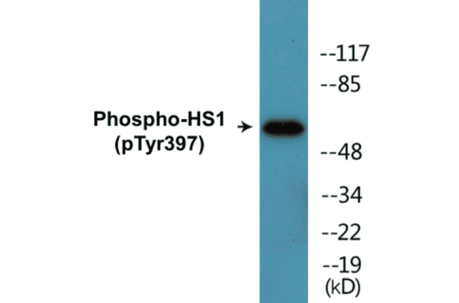 Western Blot - HS1 (phospho Tyr397) Cell Based ELISA Kit (CBP1849) - Antibodies.com