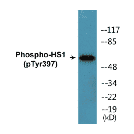 Western Blot - HS1 (phospho Tyr397) Cell Based ELISA Kit (CBP1849) - Antibodies.com