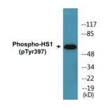 Western Blot - HS1 (phospho Tyr397) Cell Based ELISA Kit (CBP1849) - Antibodies.com