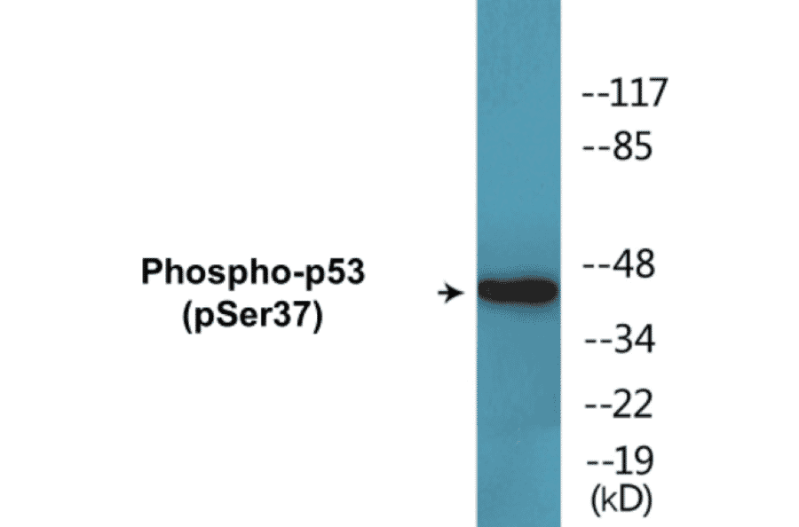 Western Blot - p53 (phospho Ser37) Cell Based ELISA Kit (CBP1645) - Antibodies.com