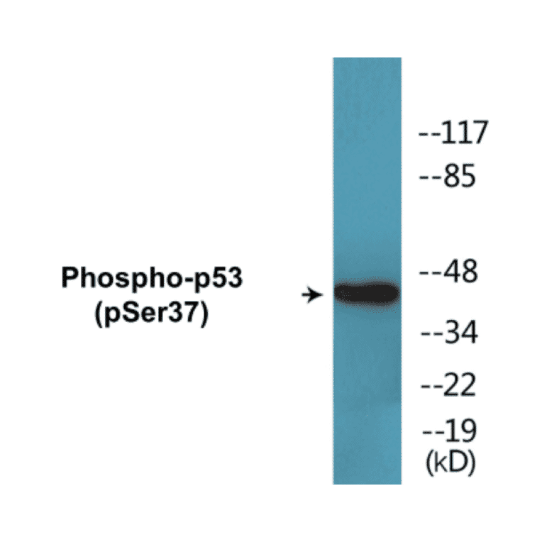 Western Blot - p53 (phospho Ser37) Cell Based ELISA Kit (CBP1645) - Antibodies.com